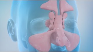 Sinusitis and Sinus Surgery Explained Balloon Sinuplasty and Endoscopic Sinus Surgery [upl. by Brabazon163]