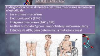 DISTROFIA MUSCULAR DE DUCHENNE [upl. by Yrrok]