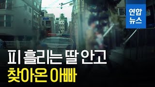 피 흘리는 딸 안고 달려온 아빠 quot이마가 찢어졌어요quot  연합뉴스 Yonhapnews [upl. by Ahseken]