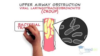 Pediatrics – Pediatric Respiratory Distress By Quynh Doan MD [upl. by Ayanat]