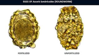 Ascaris lumbricoides overview [upl. by Ayanahs]