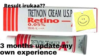 tretinoin cream usesbenefits and side effects in tamil  honest review  my 3 month update [upl. by Ronoc983]