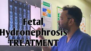 Fetal Hydronephrosis in Pregnancy Treatment  Pregnancy me Bach ki kidney me sujan ka ilaj in hindi [upl. by Fleta]