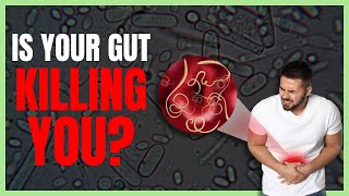 5 Steps to Heal Your Gut  Fix Gut Bacteria amp Improve Digestive Health [upl. by Mayce]