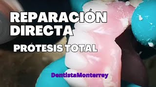 REPARACIÓN DIRECTA👅en1Cita PRÓTESIS TOTAL SUP [upl. by Derfnam711]