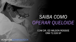 SAIBA COMO OPERAR QUELOIDE  DR ED WILSON ROSSOE  CIRURGIA DERMATOLÓGICA [upl. by Kannry593]