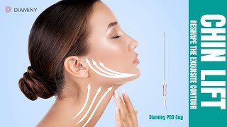 Do you know what the double chin lift procedure is Cheek lift foxeye lift with Diaminy cog thread [upl. by Florine]