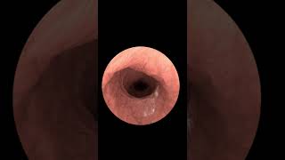 Exploring Your Insides with Gastrointestinal Endoscopy Animation 2024 [upl. by Lela460]