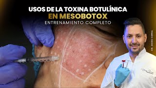 MASTERCLASS  USOS DE LA TOXINA BOTULINICA EN MESOBOTOX  DR DIEGO SERNA [upl. by Minne754]