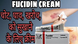 Fucidin cream review in Hindi  चोट घाव खरोच को सुखाने के लिए क्रीम [upl. by Eixid]