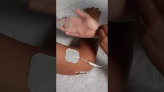 OscilacioÌn electrostaÌtica en Fibromialgia [upl. by Keene]