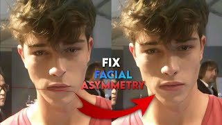 how to fix FACIAL ASYMMETRY [upl. by Eladal]