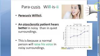 ENT Paracusis Willisii Ear Otospongiosis Otosclerosis Hear better loud speak outside home [upl. by Notsyrb381]