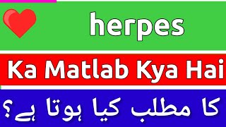 Herpes Meaning In Urdu  Herpes Meaning  Herpes Ka Matlab Kya Hota Hai  Herpes Ka Matlab Kya Hai [upl. by O'Kelly]