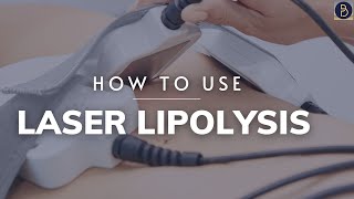 How to use Laser Lipolysis bodysculpting [upl. by Viquelia]