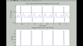 Noise Removal ECG Signal Using Non Adaptive Filters and Adaptive Filter Algorithm [upl. by Airamak]