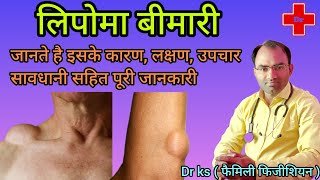 Lipoma ka ilaj l lipoma kese hota hai l lipoma kyo hota hai l [upl. by Ecertal541]