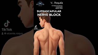 SUPRASCAPULAR NERVE BLOCK nerveblock nervepainrelief nerveblocks nervepaintreatment [upl. by Ellsworth]