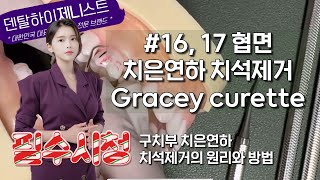 16 17 협면 구치부 치은연하 치석제거의 원리와 방법 Gracey curette  치과위생사 실기시험 그레이시 큐렛 [upl. by Enirual]