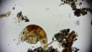 Mikroorganismus  microorganism  microorganisms under microscope in 1080p Full HD [upl. by Bindman]