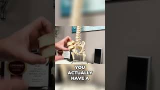 Anatomy of Lumbar Spine Disc Herniation amp Sciatica  Dr John Zielonka Chiropractor In Ottawa [upl. by Henryetta]