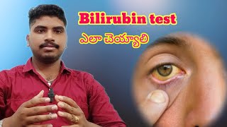 How to Bilirubin test in TeluguBilirubin test in Telugu bloodpressure bilirubin [upl. by Anirehtac]