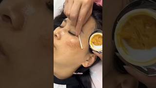 Remove Dark Spots amp Pigmentation Naturally At Home  Get Glowing Skin skin beautiful shorts [upl. by Ardme200]