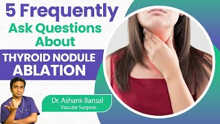 5 Questions Answered About Thyroid Nodule Ablation By Dr Ashank Bansal [upl. by Tepper]