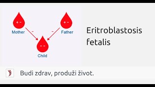 Eritroblastosis fetalis [upl. by Starlin]