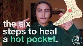 The Fastest Way To Heal A Hot Pocket [upl. by Rendrag]