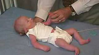 neurology exam newbornabnormal Primitive Reflexes  Moro [upl. by Drawe]