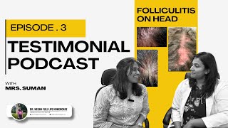 Folliculitis on the Head Dr Megha amp Mrs Suman Share Real Experiences Testimonial Podcast [upl. by Nev402]