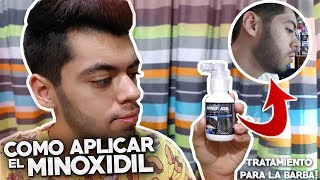 ASÍ DEBES APLICAR EL MINOXIDIL  TIPS DEL MINOXIDIL [upl. by Hodess]