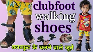 क्लब्फूट में चलने वाले जूते को कैसे पहनाएं । clubfoot walking shoes  ctev day time shoes [upl. by Tyrrell]