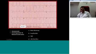 Pedicardio classes on ECG in arrhythmias with Quiz by Dr Ulhas Pandurangi [upl. by Katrinka]