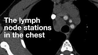 The Lymph Node Stations in the Chest [upl. by Churchill]