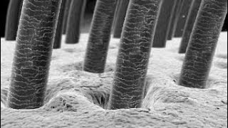 hair under microscope human hair under microscope [upl. by Samuela]