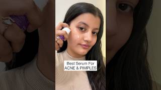 Best ANTIACNE Serum In India  Salicylic Acid  Niacinamide [upl. by Fesuy]