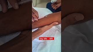 dog bite  ARV dog bite vaccine docter medical [upl. by Vail]