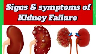 Signs amp Symptoms of kidney failure [upl. by Lemart]