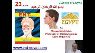 Larynx 3 Mosaad AbdelAziz Tumors of Larynx [upl. by Belac]