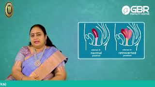 What is Retroverted Uterus பின்னோக்கிய கருப்பை குழந்தையின்மைக்கு காரணமா Dr Buvaneswari Explains [upl. by Solly]