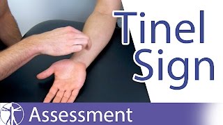 Tinel Sign Wrist  Carpal Tunnel Syndrome Diagnosis [upl. by Eitsirhc]