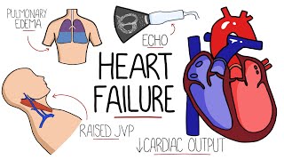 Heart Failure Explained  HFrEF vs HFpEF Systolic vs Diastolic Heart Failure [upl. by Heindrick81]