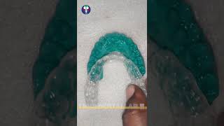 Toothsi  Dentist Lab World  Orthodontics Teeth Treatment  Painless  Tamil Dental Lab🦷dentallab [upl. by Nerehs]