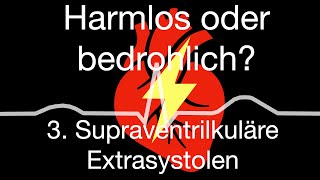 Herzrhythmusstörungen zwischen harmlos oder bedrohlich 3 supraventrikuläre Extraschläge [upl. by Gurl]