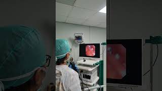 Bronchoscopy or bronkoskopi part 3 [upl. by Eniak]