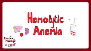 HEMOLYTIC ANEMIA Extravascular v Intravascular Clinical Features Diagnosis Coombs Test  Rhesus [upl. by Priestley]