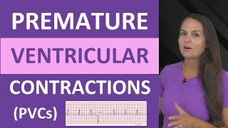 Premature Ventricular Contractions PVCs ECG Nursing NCLEX Bigeminy Trigeminy [upl. by Elocel]