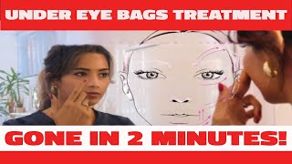 I tried quotThisquot Under Eye Bags Treatment That Works in 2 Minutes [upl. by Eittel]